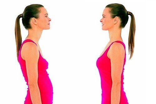 Как осанка влияет на здоровье вашего позвоночника